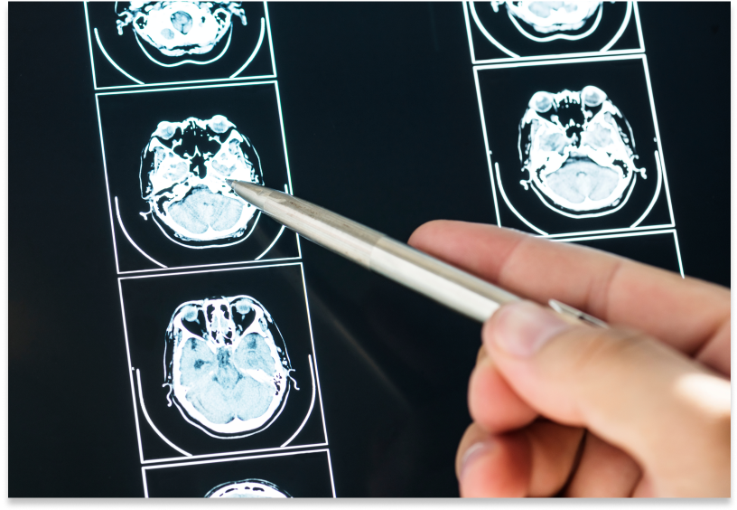 closeup-of-brain-mri-scan-result-2021-08-26-23-57-27-utc 1 (1) (1)